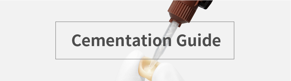 Cementation Guide