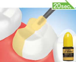 Apply PRIMER