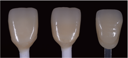 Comparison with high