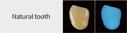 Natural tooth