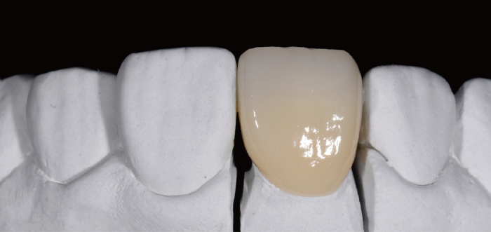 Transparent after firing